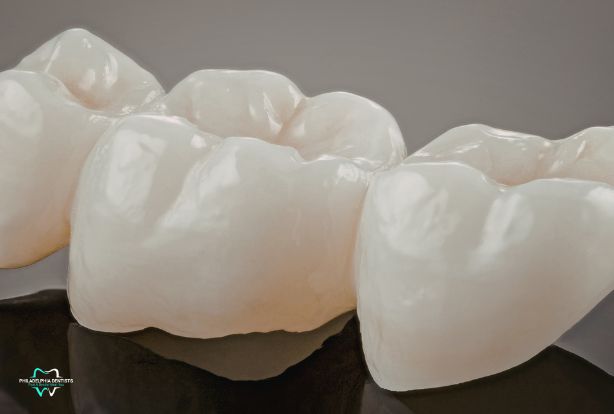 Find Dental Crowns Near You in Philadelphia